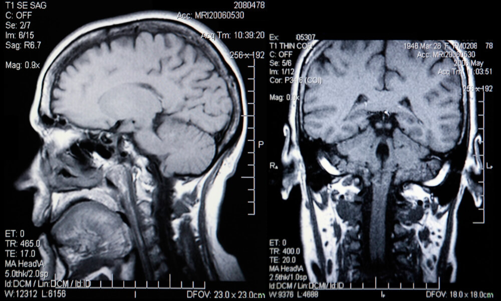 CT and MRI Imaging Presented by PostDICOM